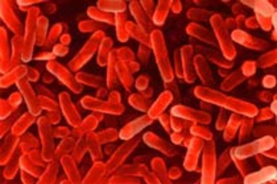 Legionella-pneumophila- - 42TČen